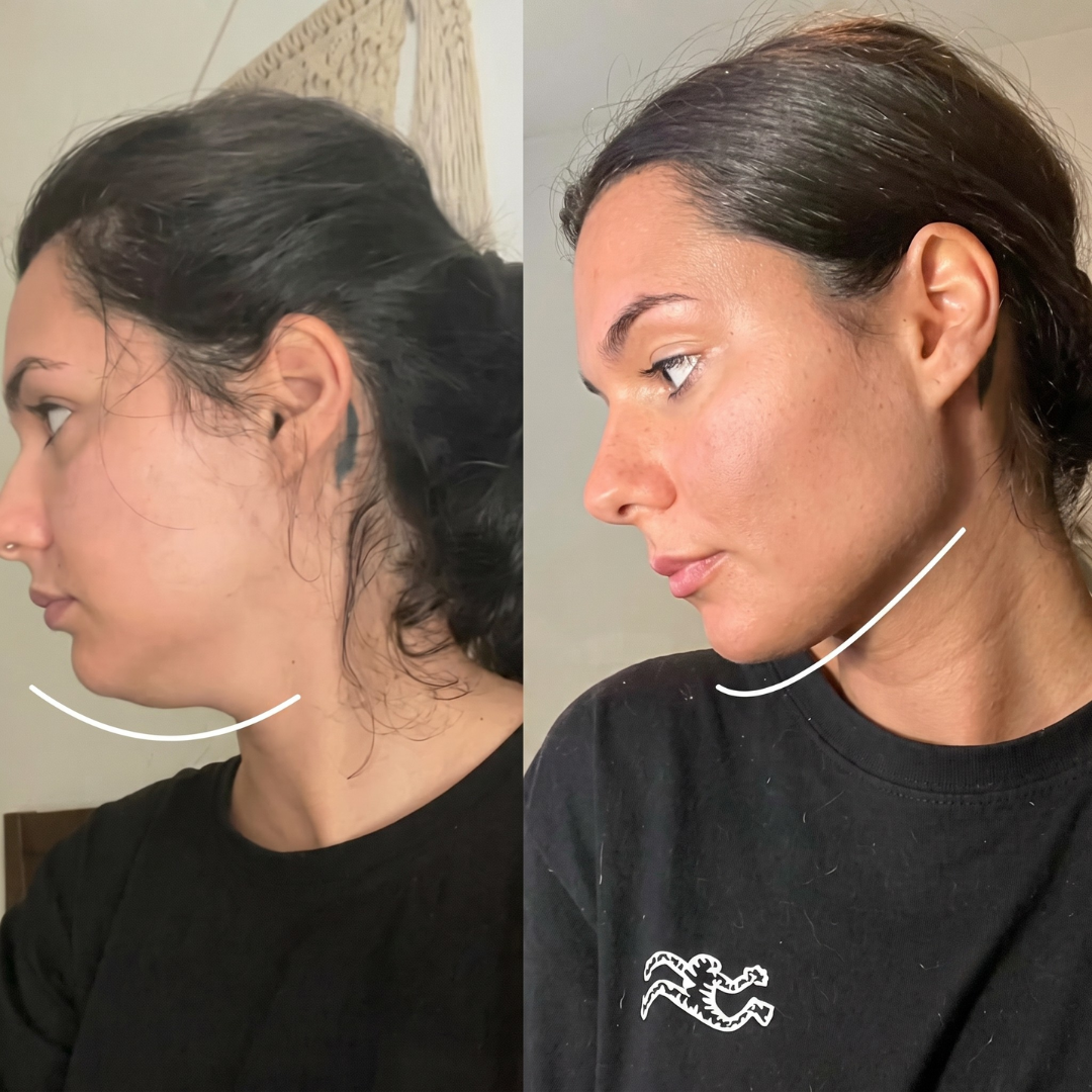 Split face, vänster halva borstad